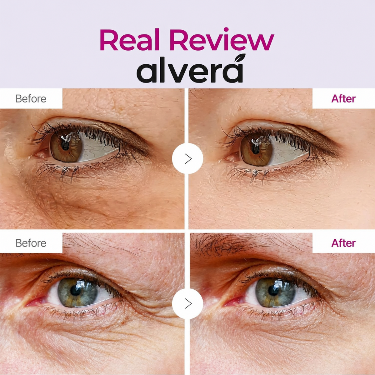 Anti Wrinkle Calcium Eye Patch