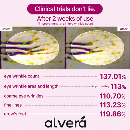 Anti Wrinkle Calcium Eye Patch